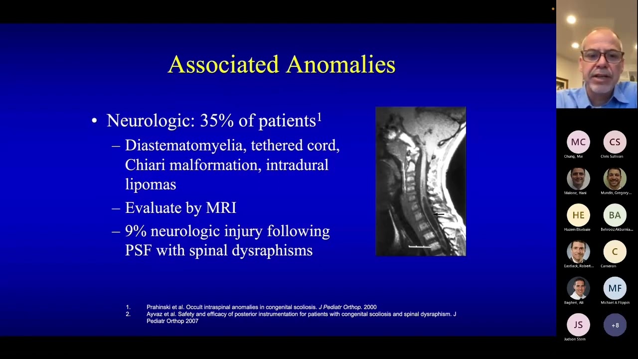 Congenital Scoliosis presented by Burt Yaszay, MD on May 1, 2023.