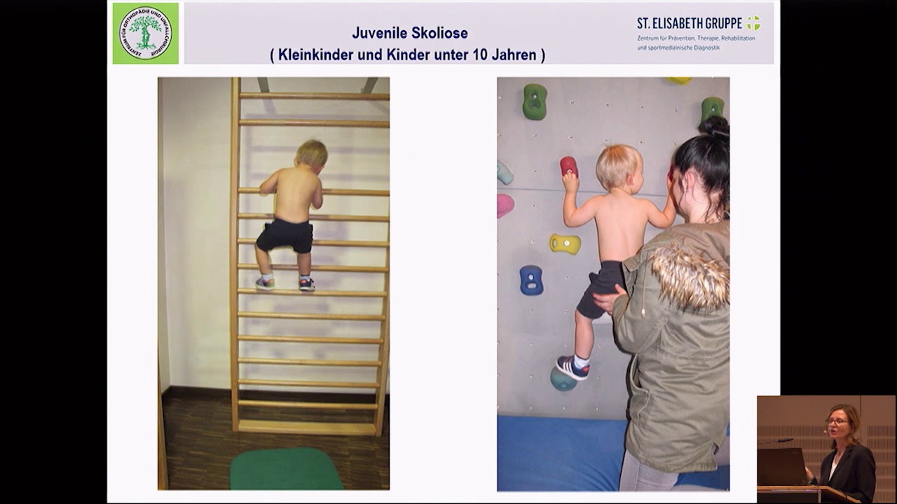 04/15 - Skoliosebehandlung bei Kindern mittels Physiotherapie Teil 1