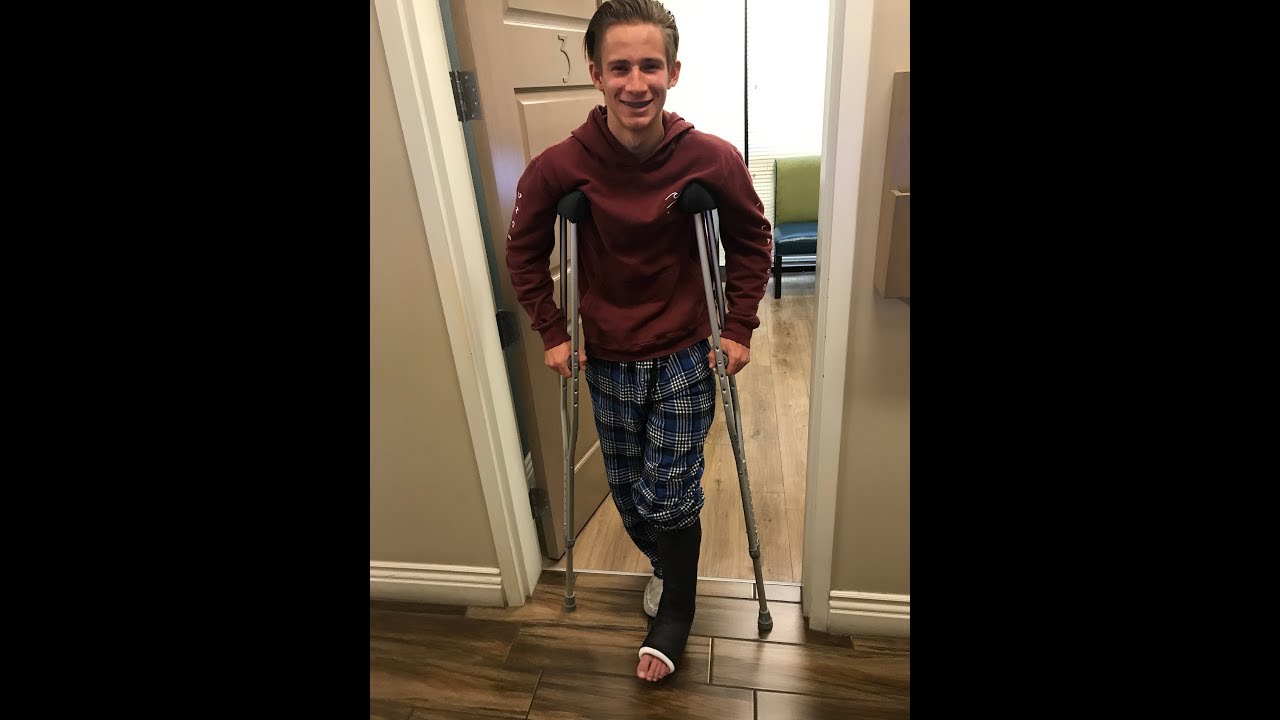 fully dislocated