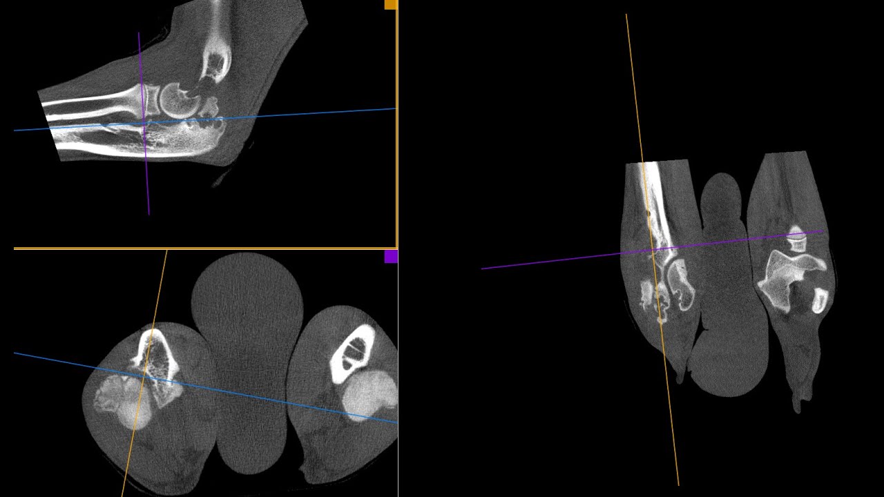 Elbow Dysplasia Syndrome in canine scanned by Vimago HDVI CT