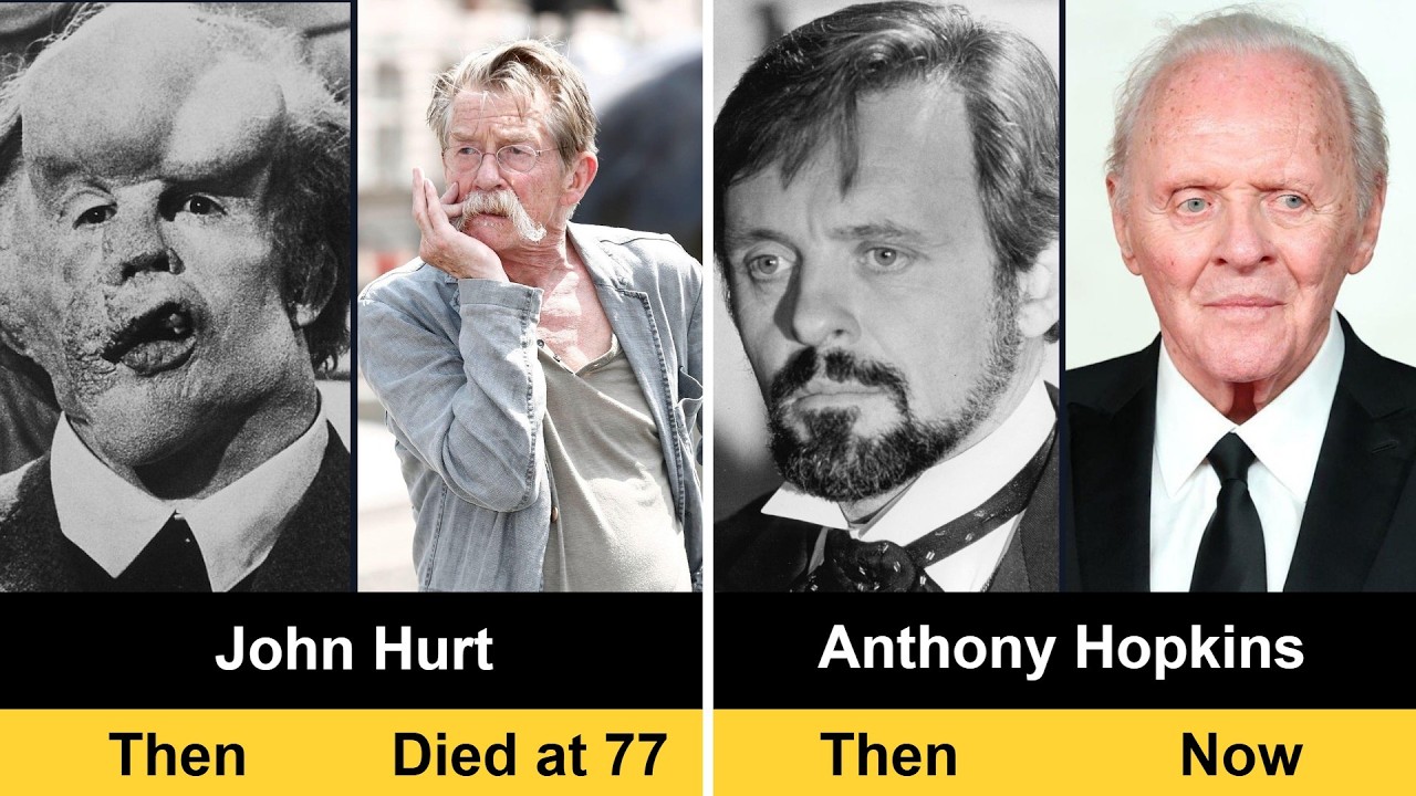 The Elephant Man 1980 Cast THEN and NOW 2026 – Quiet Reflections on a Film That Changed Hearts
