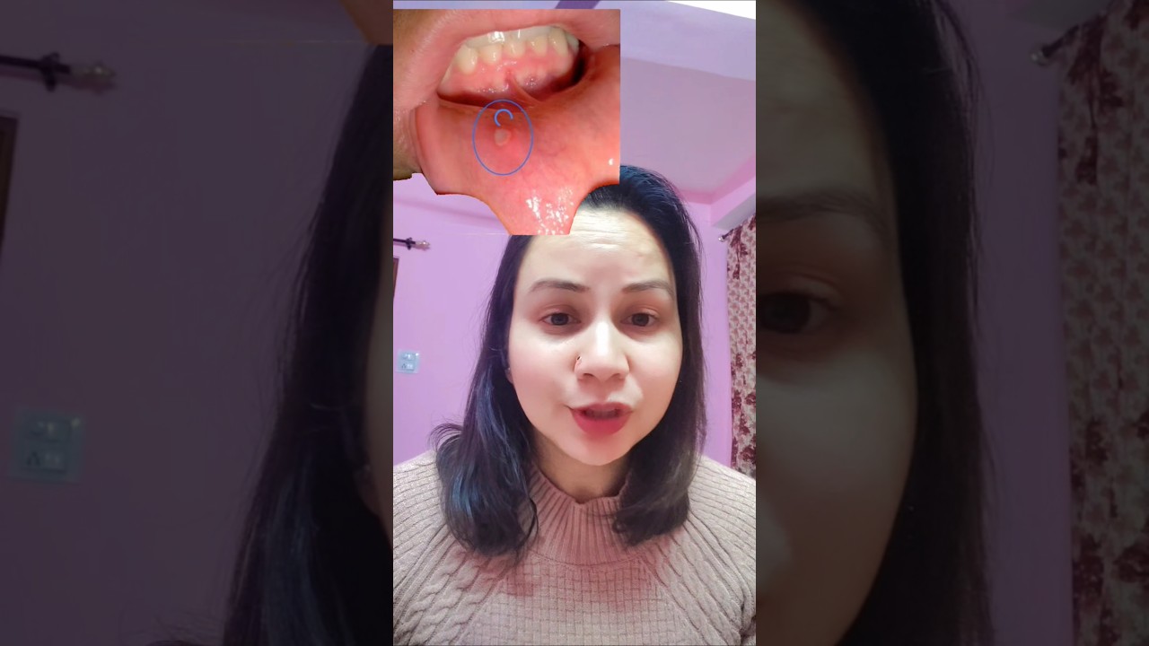oral sore, decreased Libido this may be the cause.