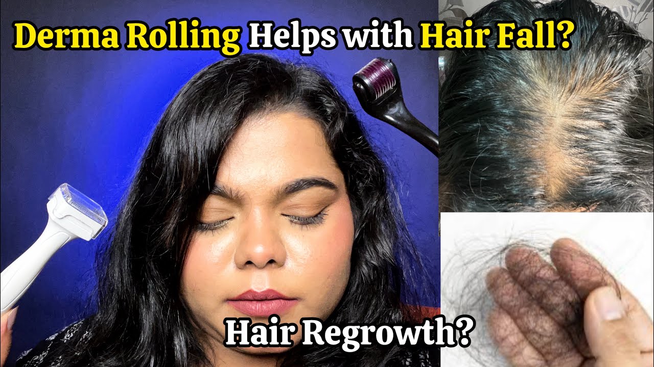 Derma Roller for HAIR REGROWTH | Derma stamping Results | How to use derma roller at home for hair?