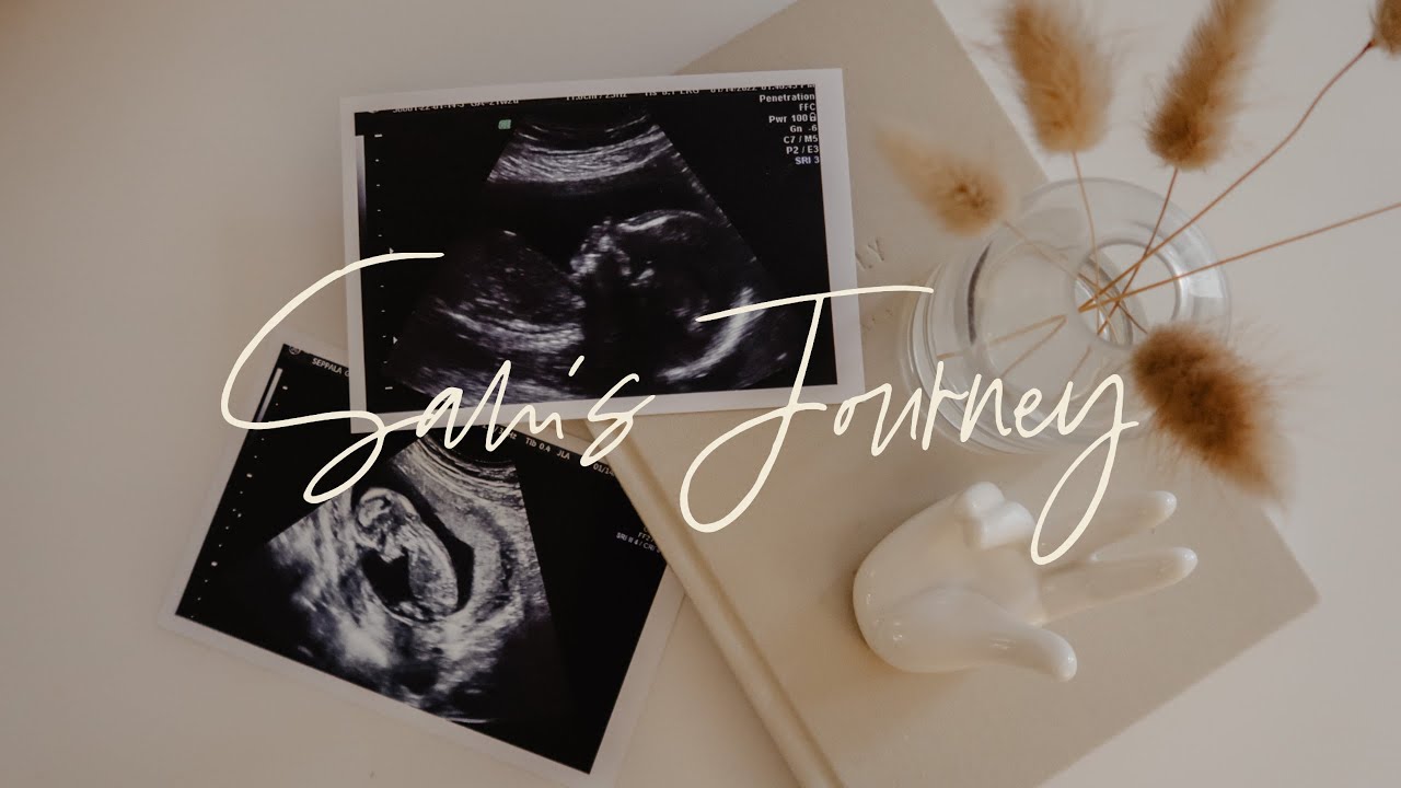SAM'S JOURNEY WITH CDH // Congenital Diaphragmatic Hernia