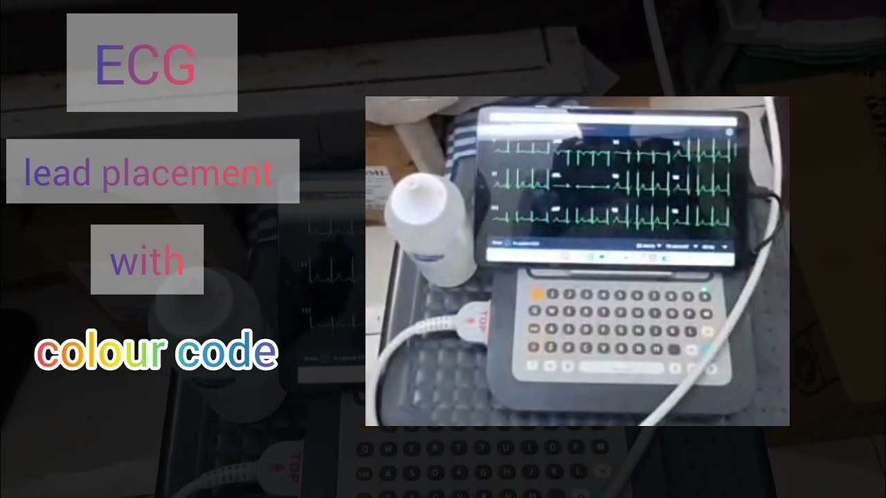 ECG lead placement with colour code || how to take ECG #ECG #electrocardiogram #medicalknowledge 