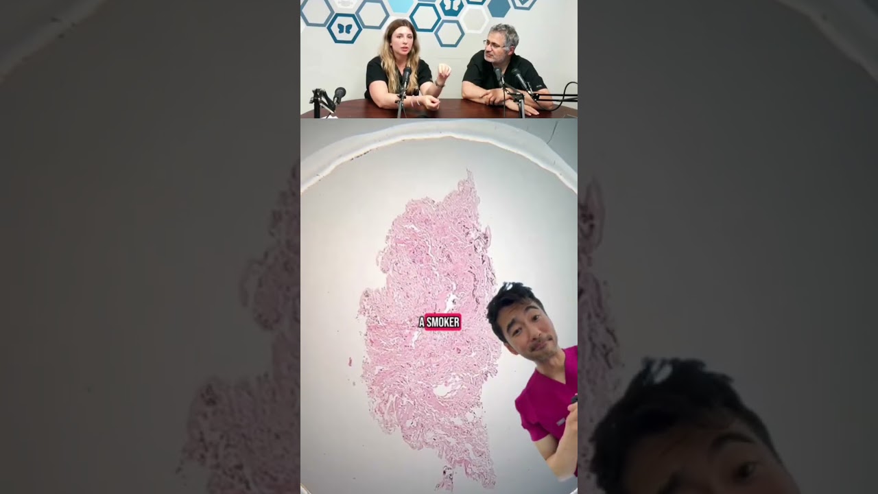 Popcorn Lung: The Hidden Danger of Vaping