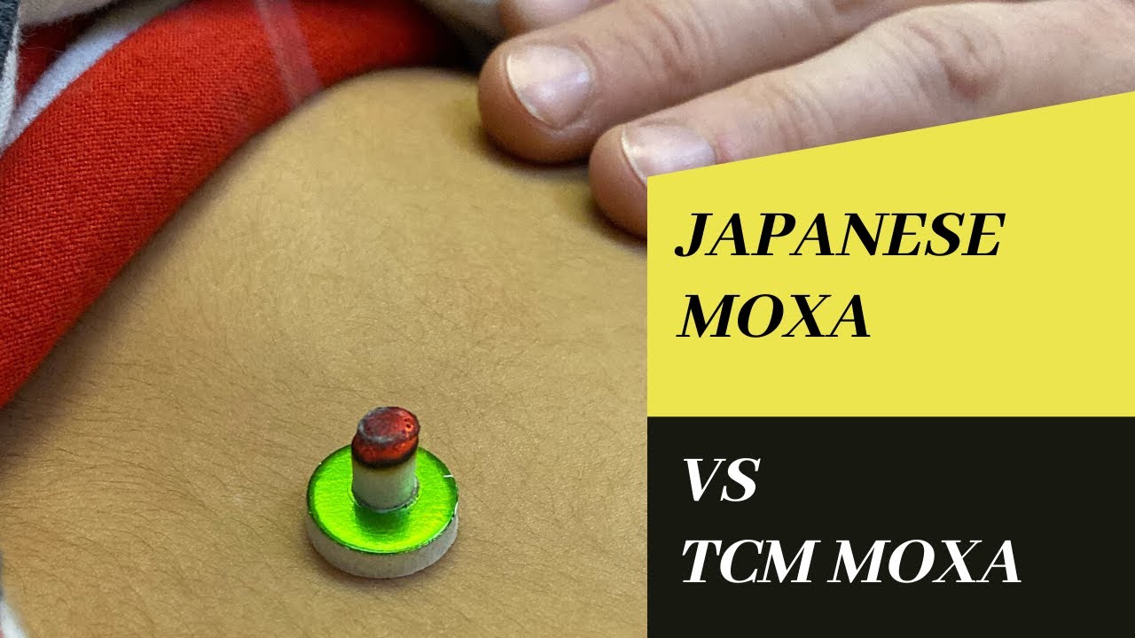 Japanese moxa vs TCM moxa