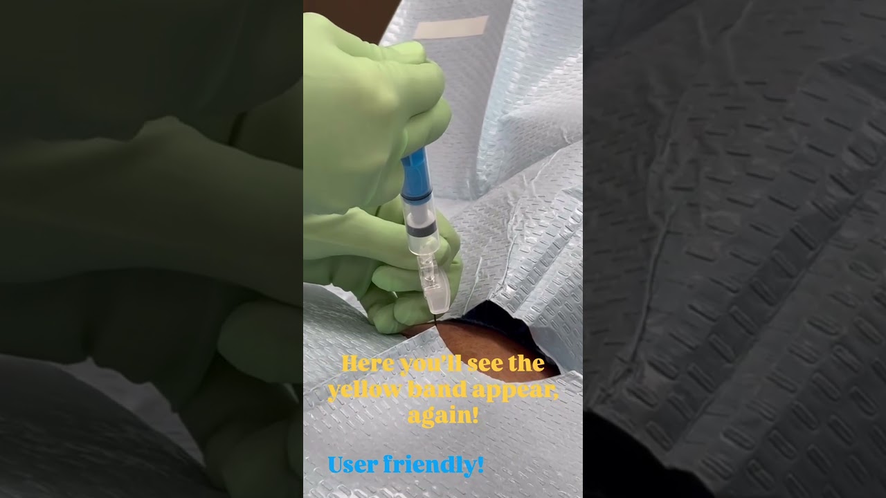 Why I Use the EpiFaith Smart Syringe in My Practice- Dr. Jordan Tate