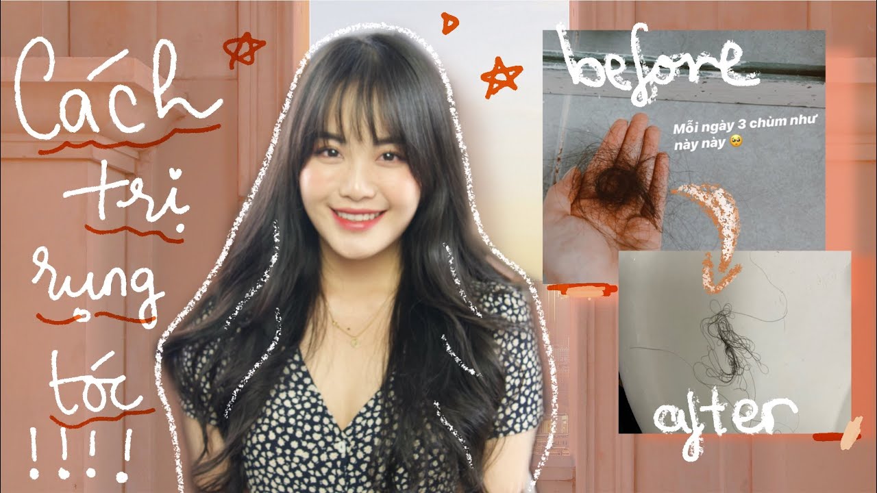 Những sản phẩm trị rụng tóc hiệu quả nhất | LAN ANH ♡