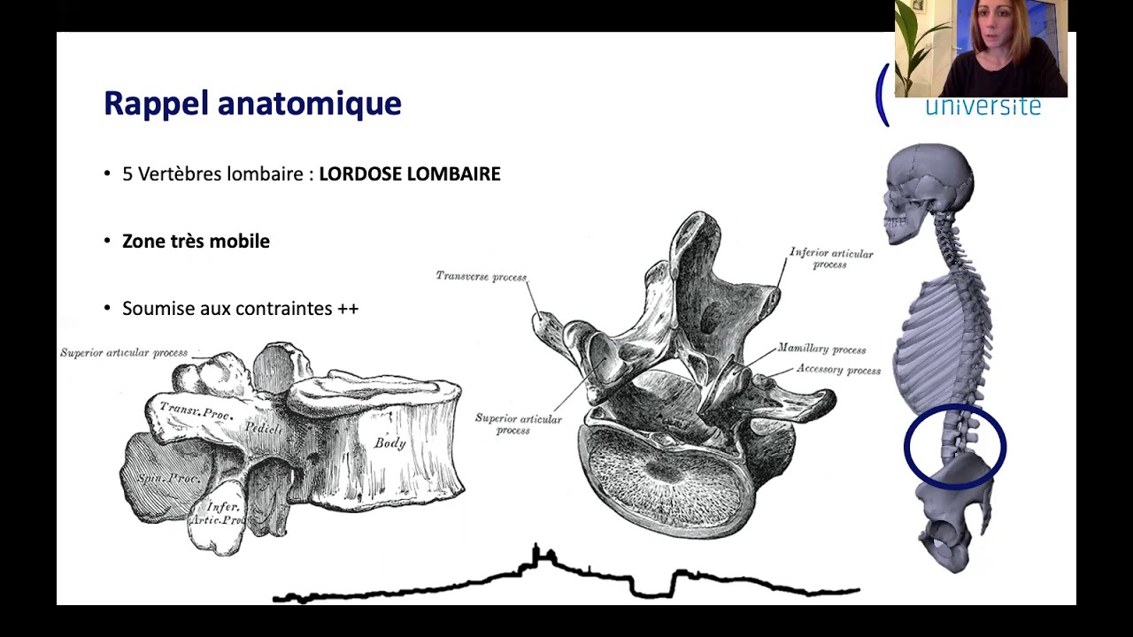 Les fractures du rachis thoracolombaire, Dr Solene Prost (Sce Prs Tropiano & Blondel)