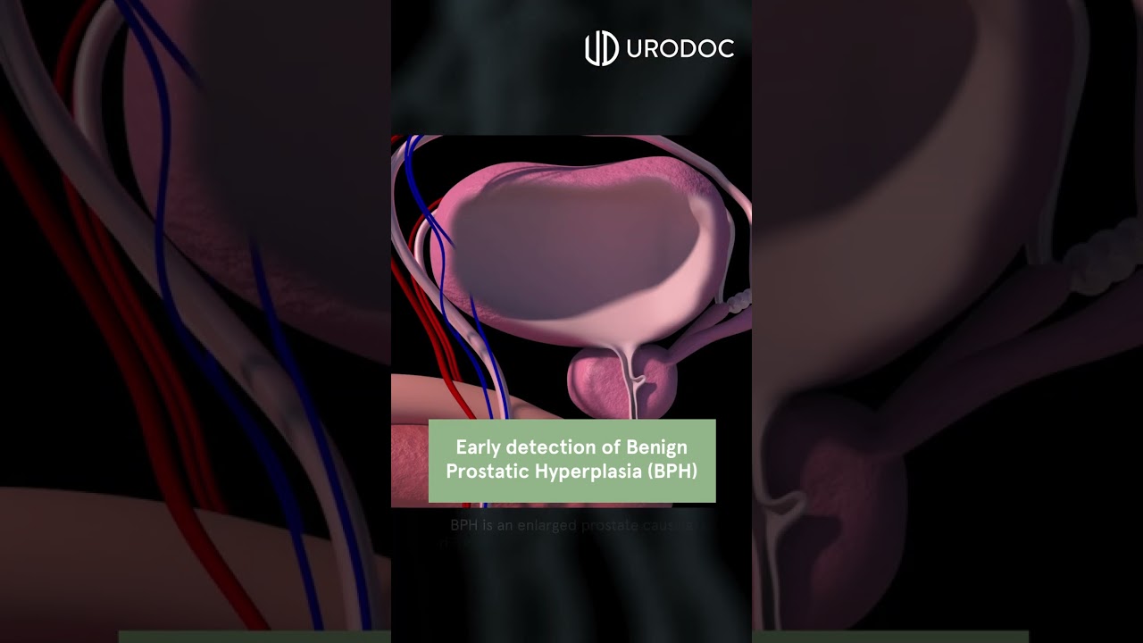 3 Reasons To Check Your Prostate