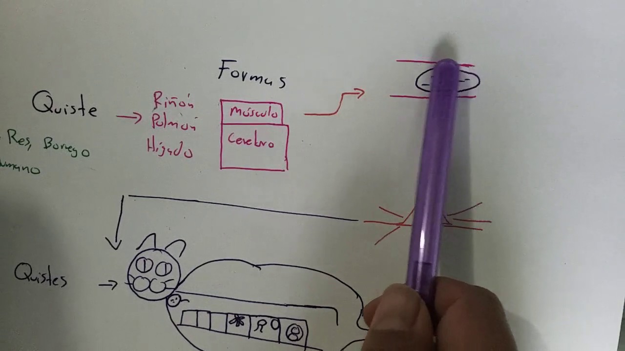 Toxoplasmosis