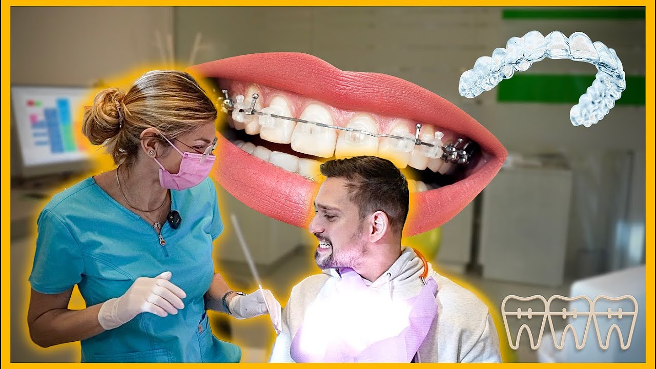 Mi-am pus aparat dentar invizibil! De ce?