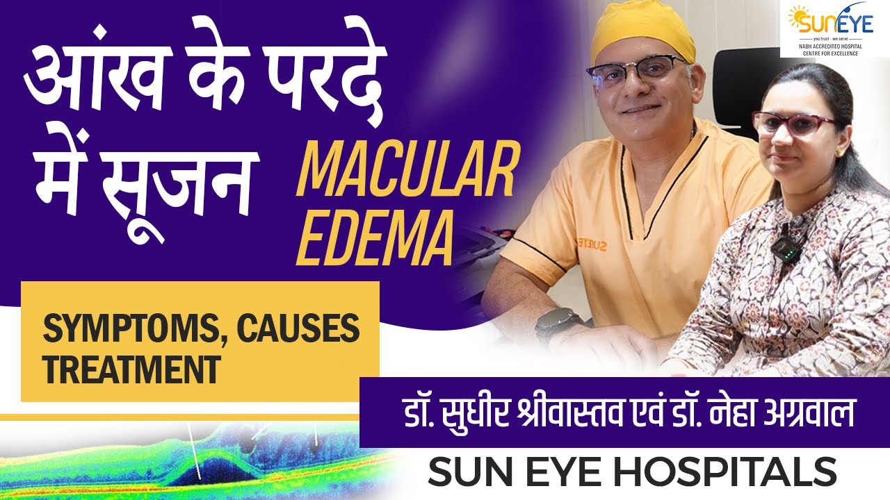 Macular edema, Causes, Symptoms and Treatment in hindi, Diabetic macular edema #suneyecafe