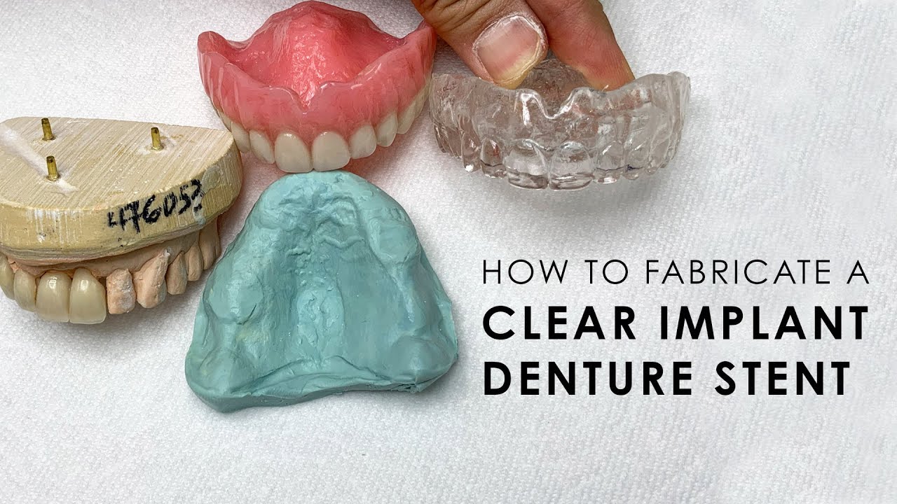 How to fabricate a Clear Implant Denture Stent