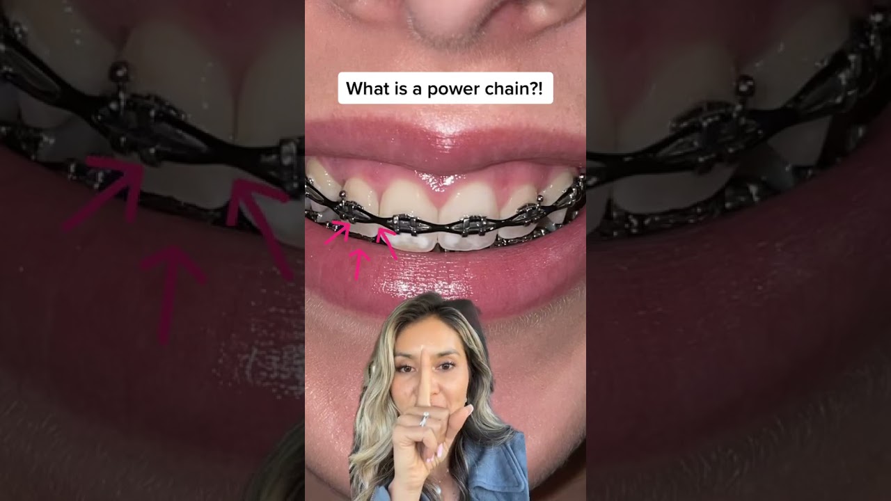 What is a Power Chain?