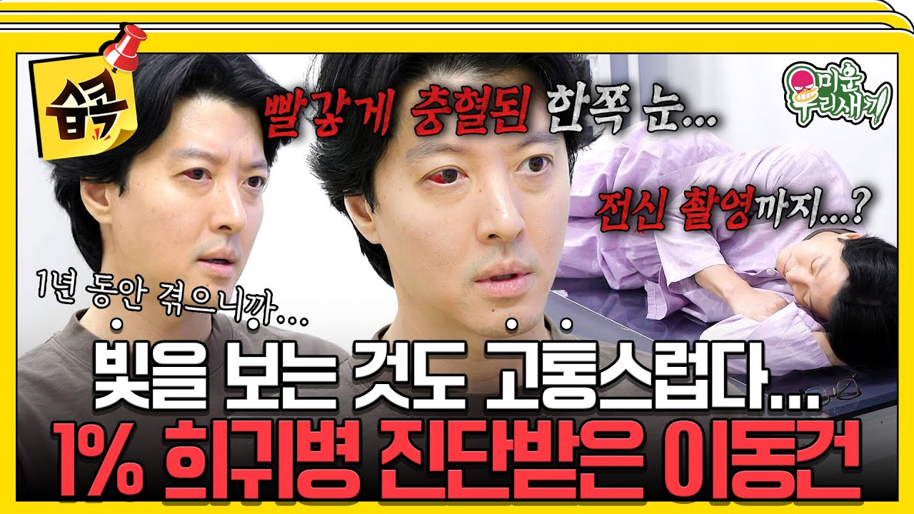 [#습콕📌] 빨갛게 충혈된 오른쪽 눈...💥 인구 약 1%만 걸리는 희귀 난치성 질환 진단받은 이동건😭 #미운우리새끼 #MyLittleOldBoy #SBSenter