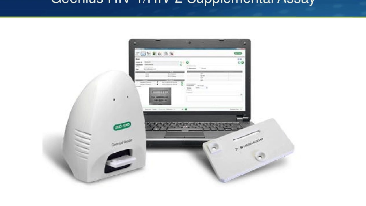 Diagnostic Tests for HIV