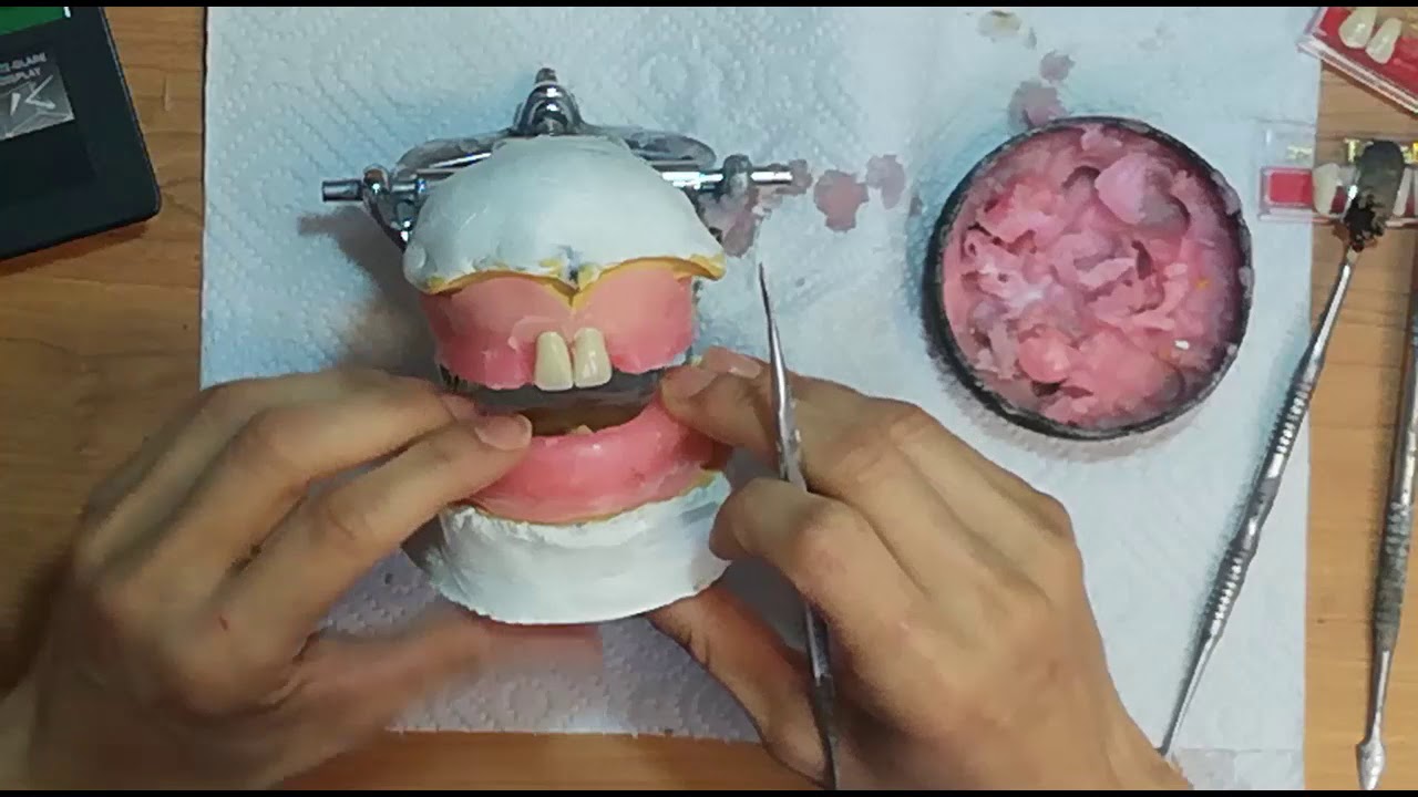 CURSO ARTICULADO PROTESIS TOTALES
