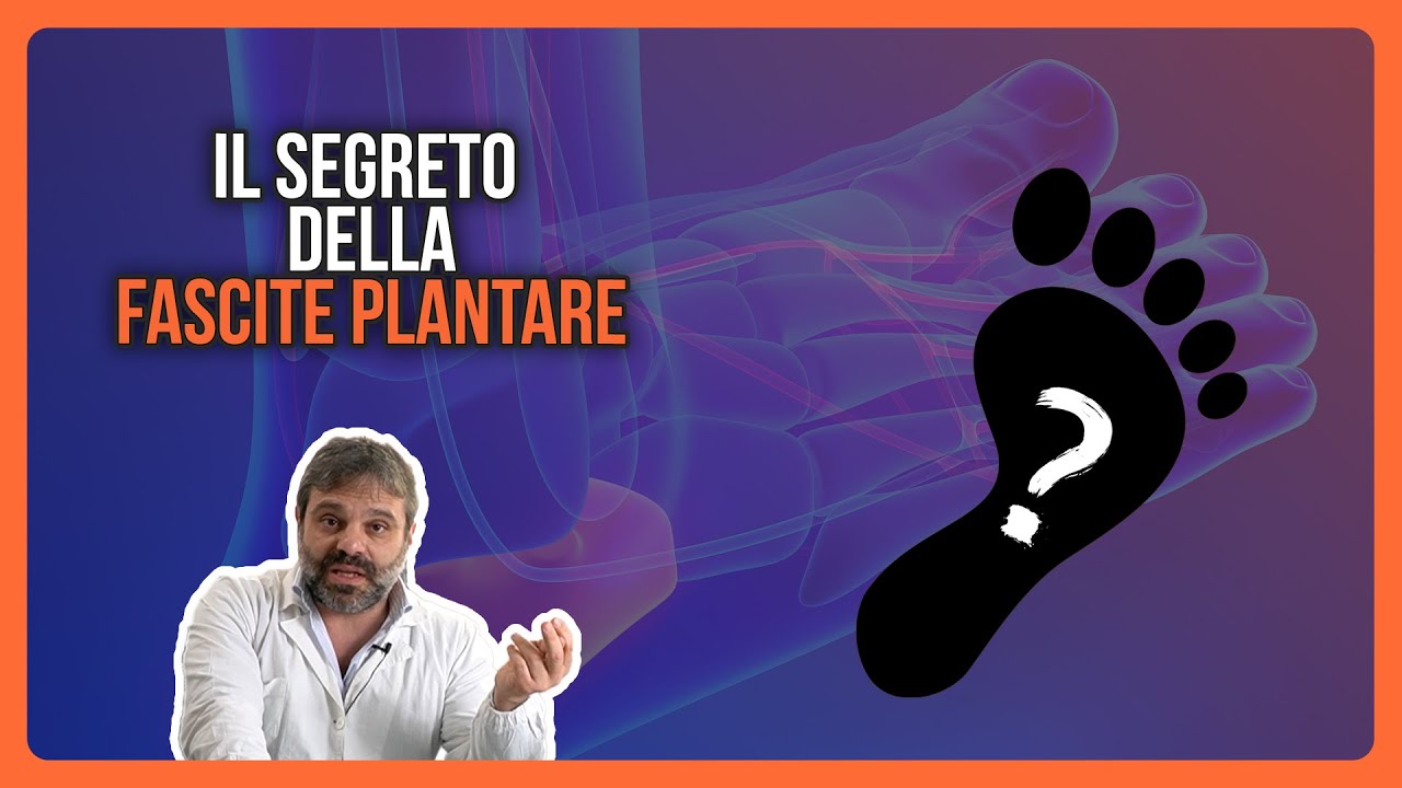 FASCITE PLANTARE: Perchè non GUARISCE, la SOLUZIONE DEFINITIVA