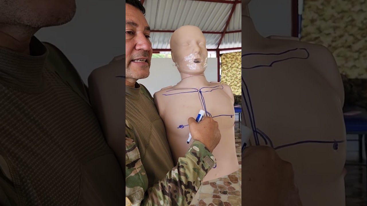 Forma correcta para hacer RCP