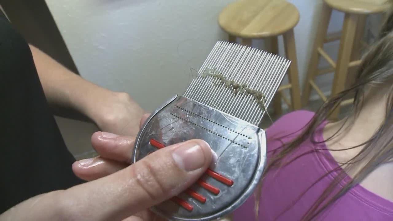Super lice becomes a bigger problem in Albuquerque