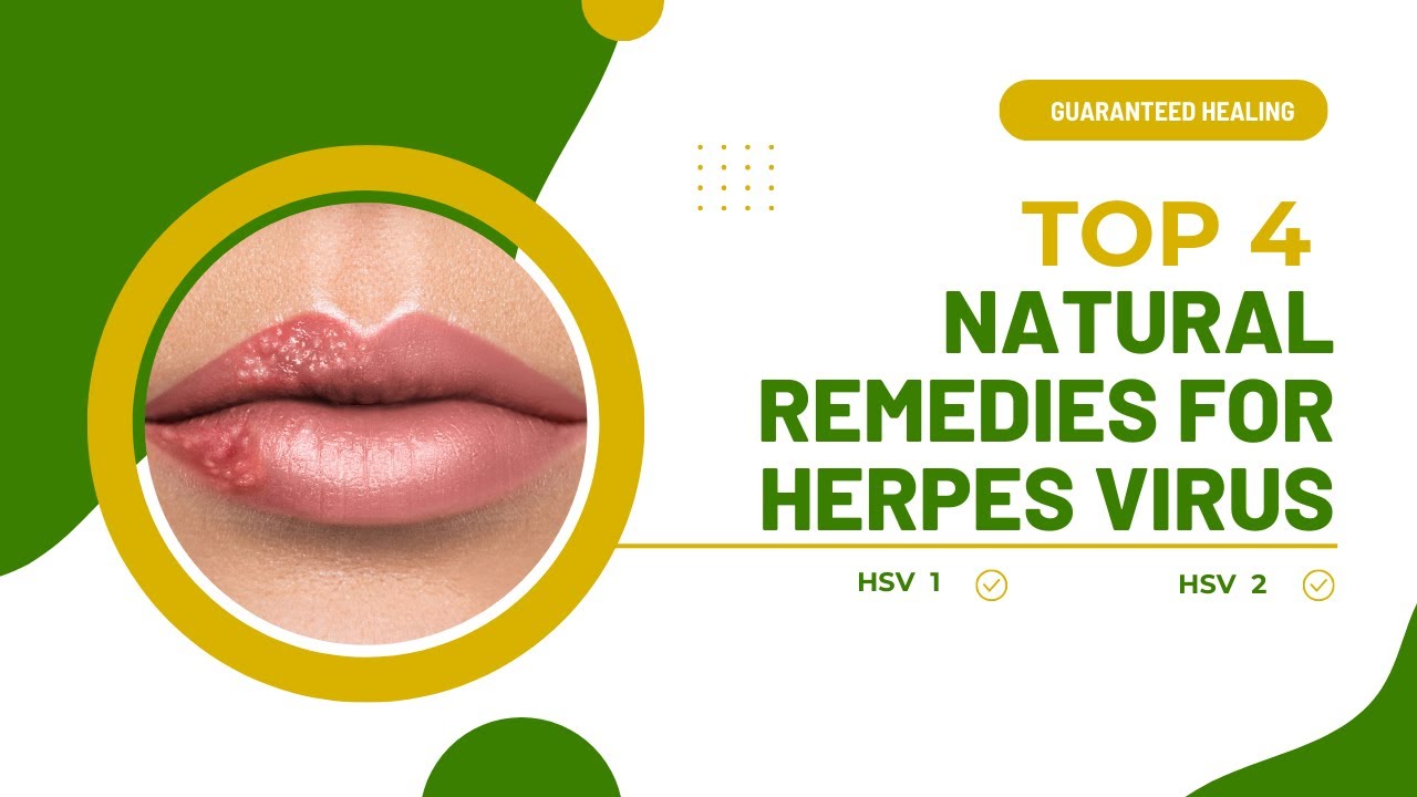 4 Proven Natural Remedies for Herpes: Heal Yourself Naturally!