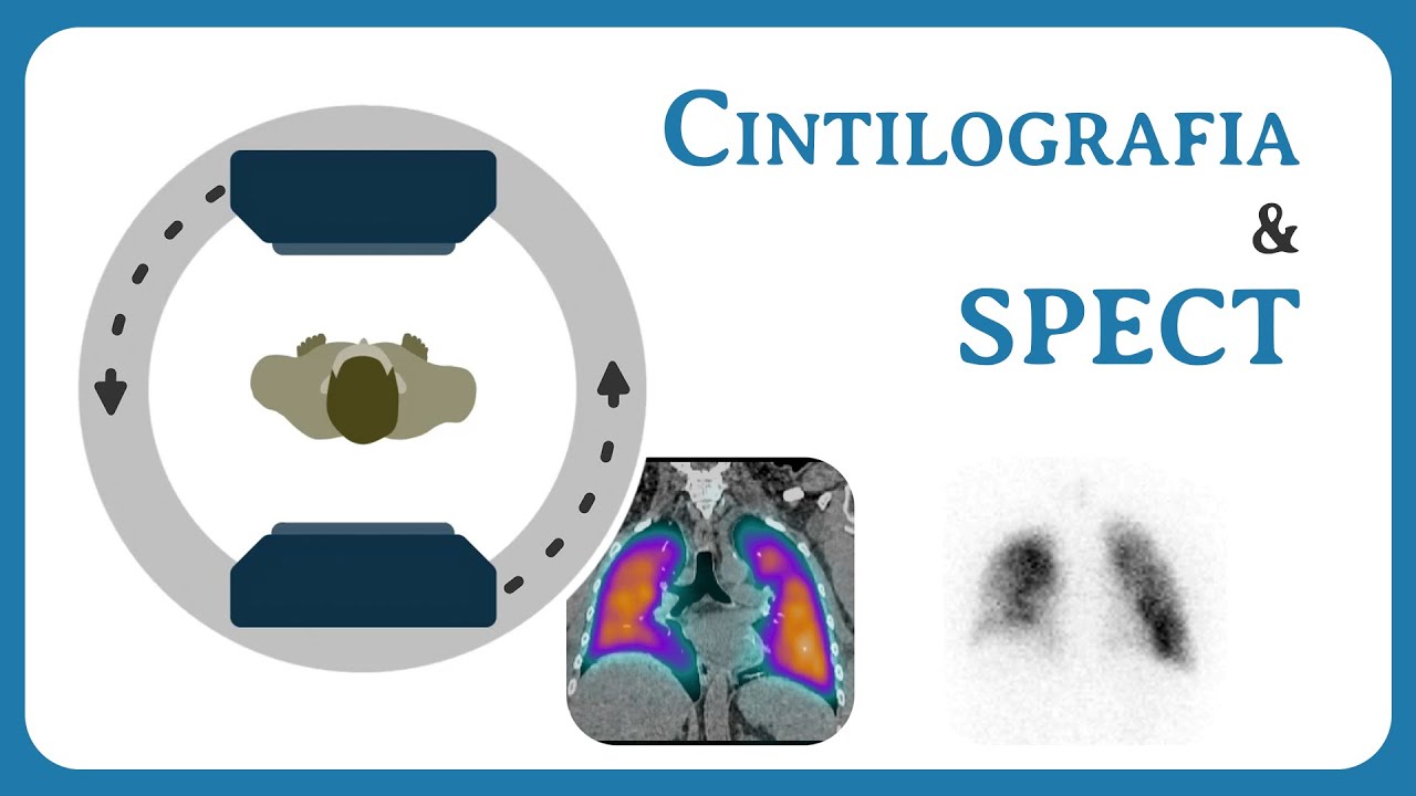 Cintilografia e SPECT