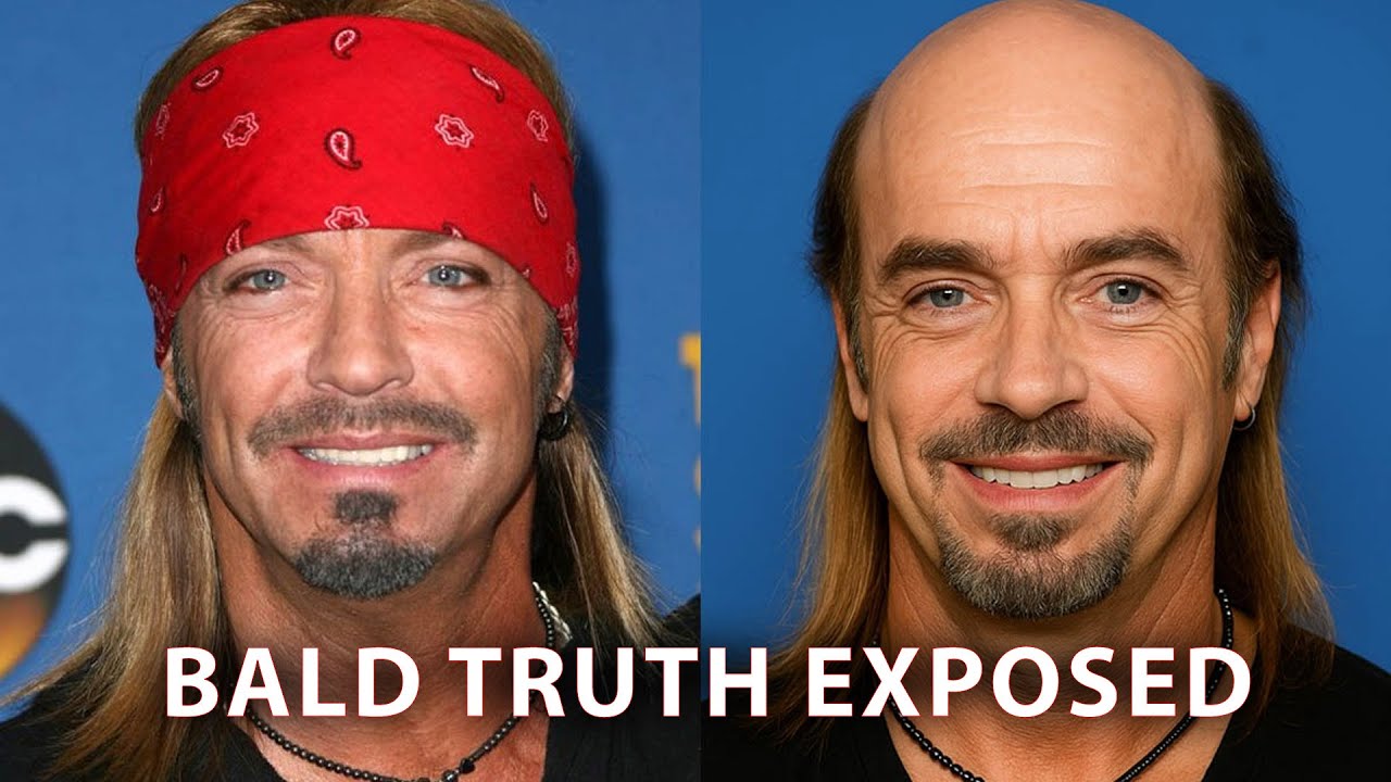 Poison's Bret Michaels Hiding Baldness With Bandana?