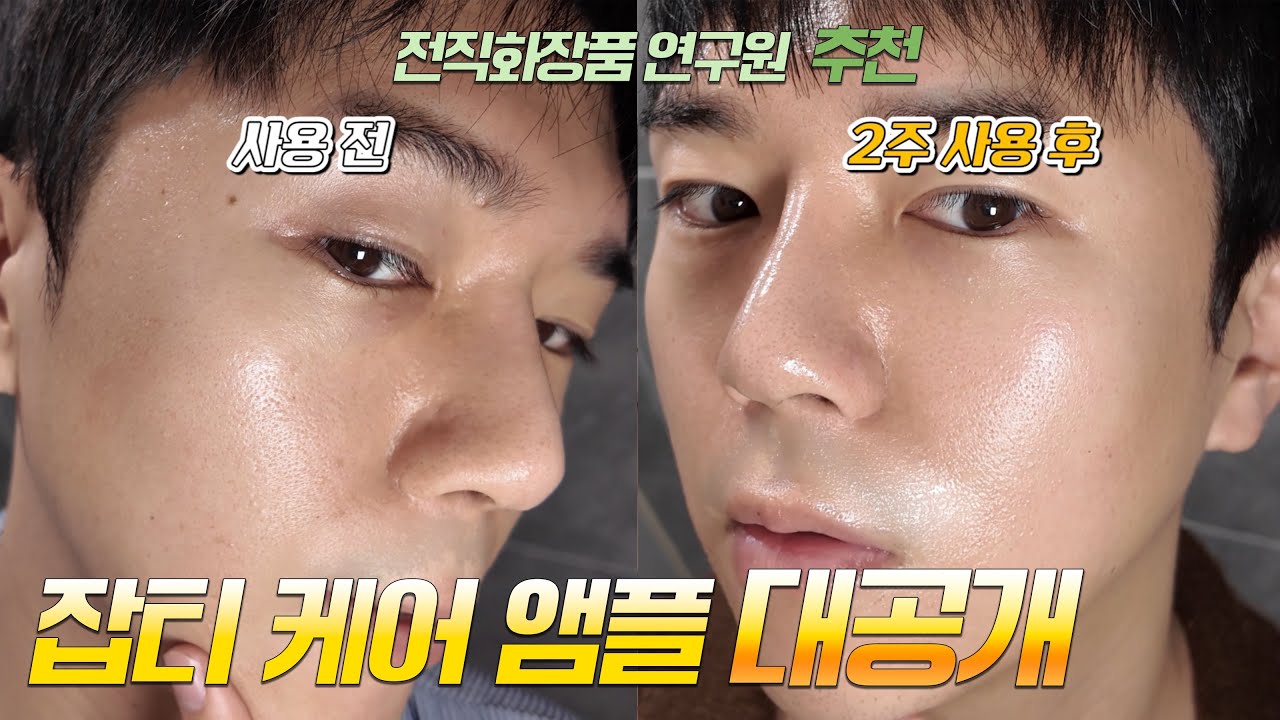 피부 잡티 톤 케어 | 미백 앰플 추천 | 글루타치온 앰플 | 블랙프라이데이