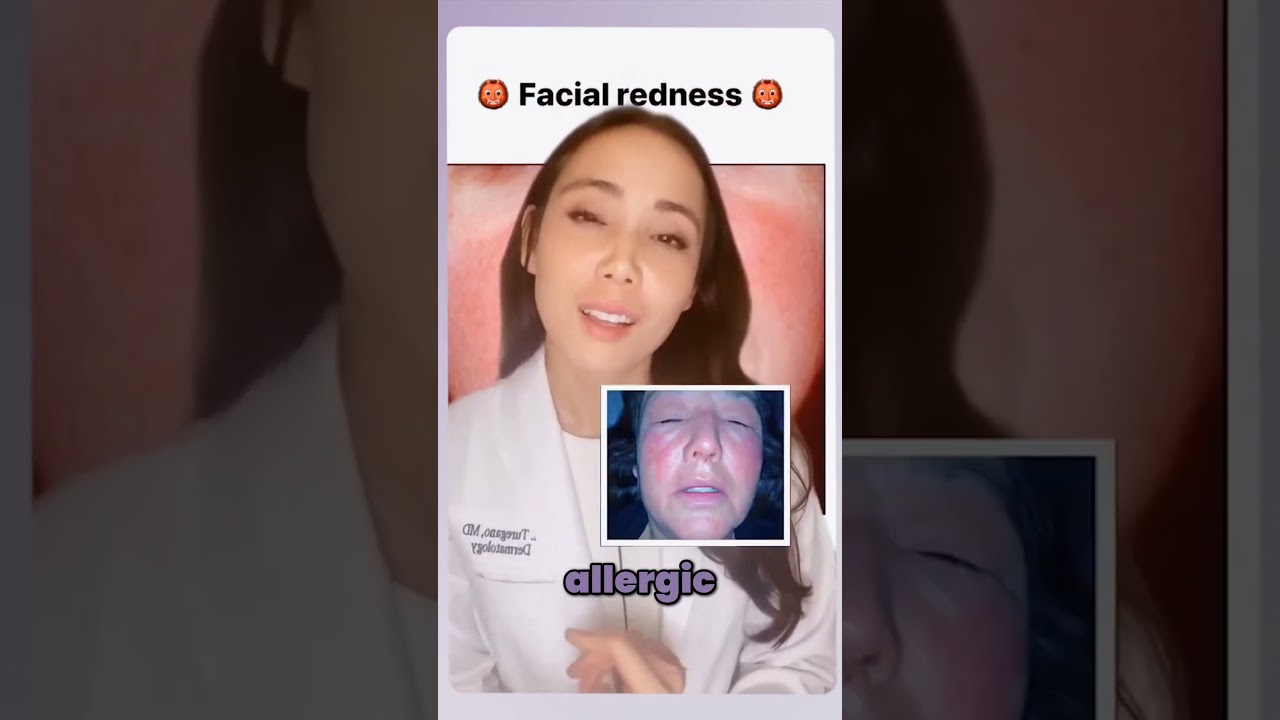 Causes of Facial Redness