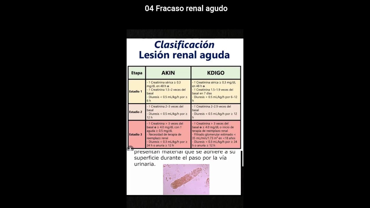 04 Fracaso renal agudo