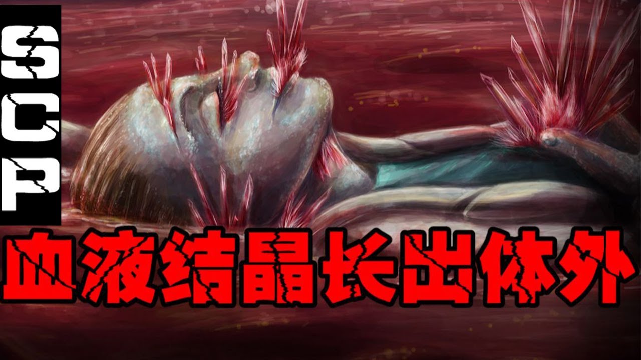 【SCP-红冰】碰到后身体血液变成固态，可以毁灭世界的冰块【郑郑得证】