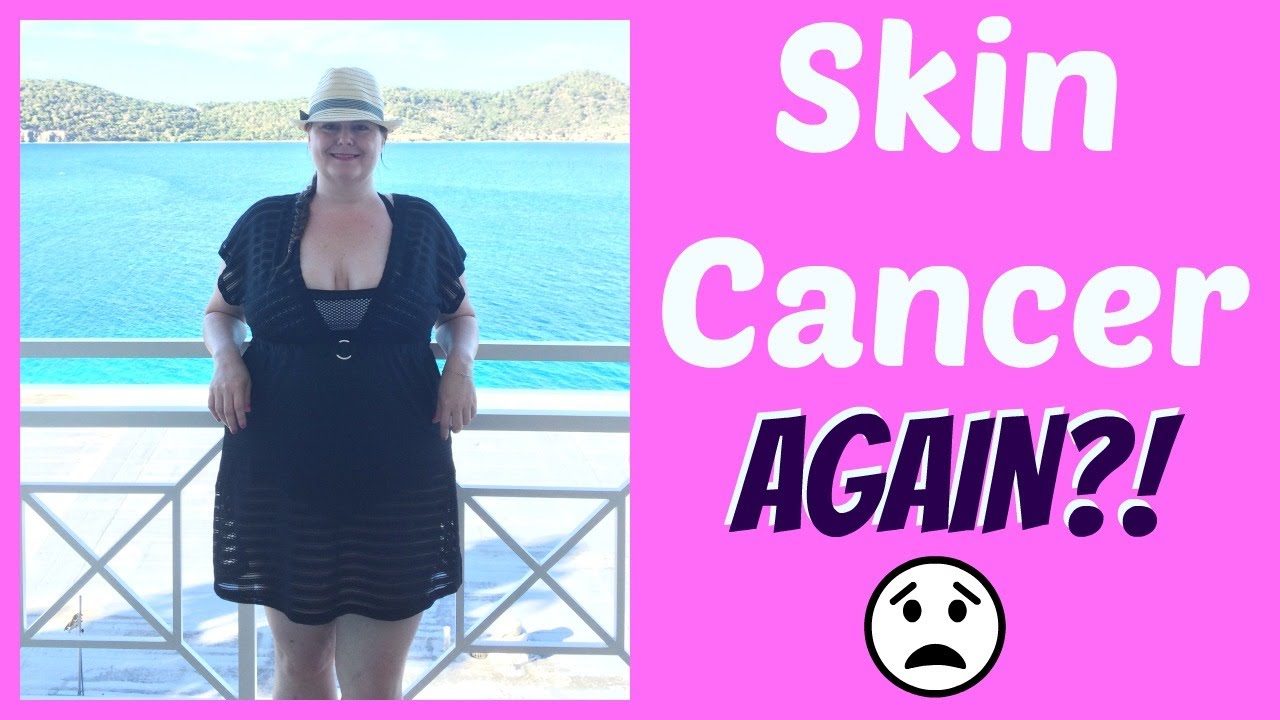 Basal Cell Carcinoma | My Skin Cancer Story - The Truth | What I wish I knew