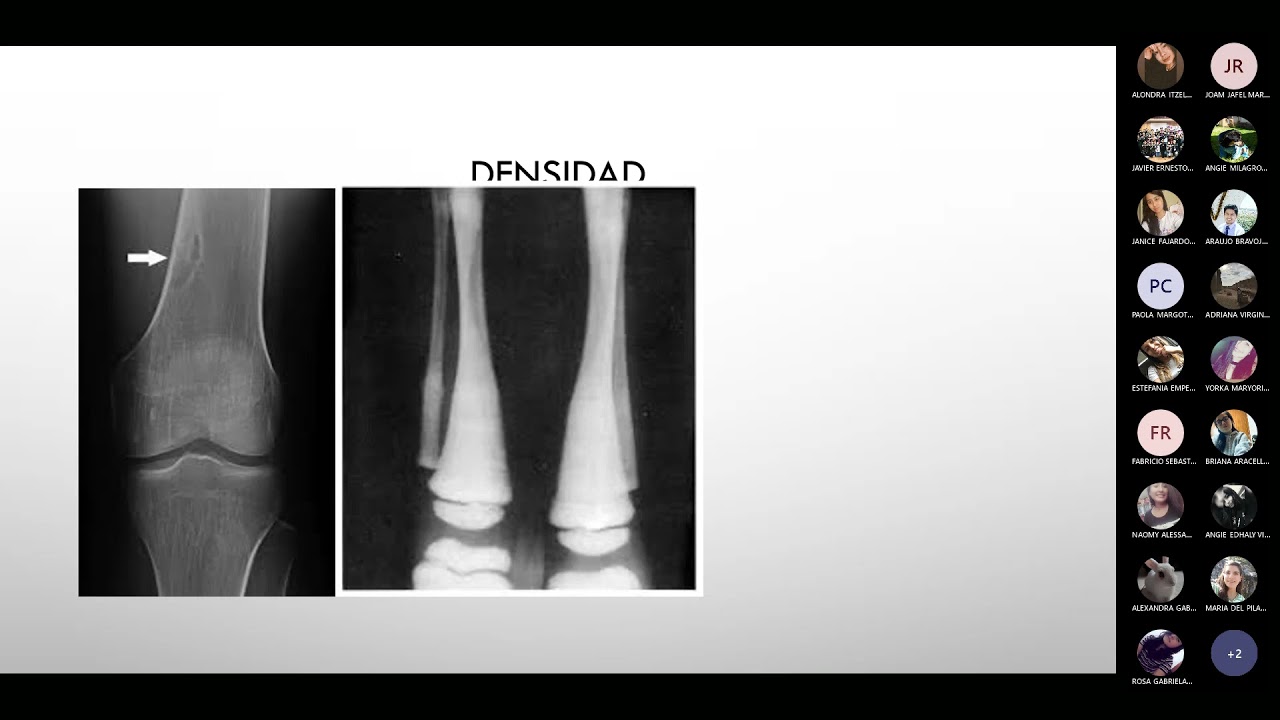 FASE 3 - CLASE 03: IMAGENOLOGÍA OSTEOARTICULAR