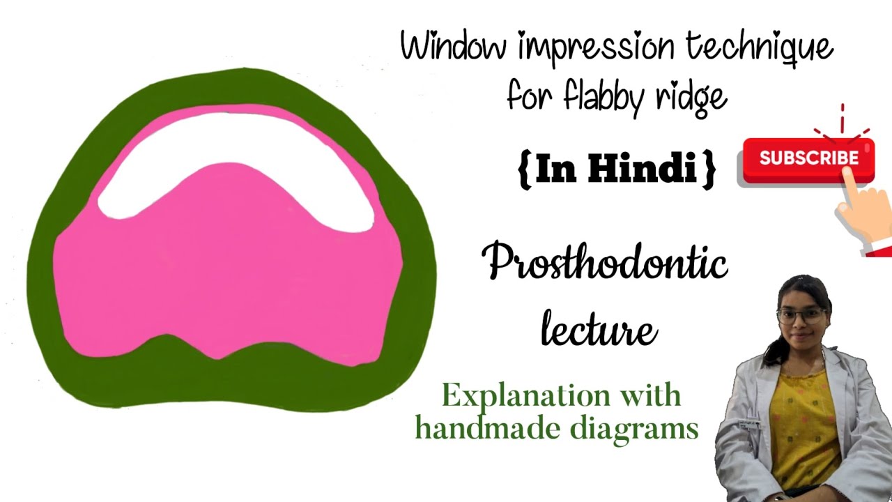 Window impression technique in hindi | window impression technique for flabby ridge in hindi