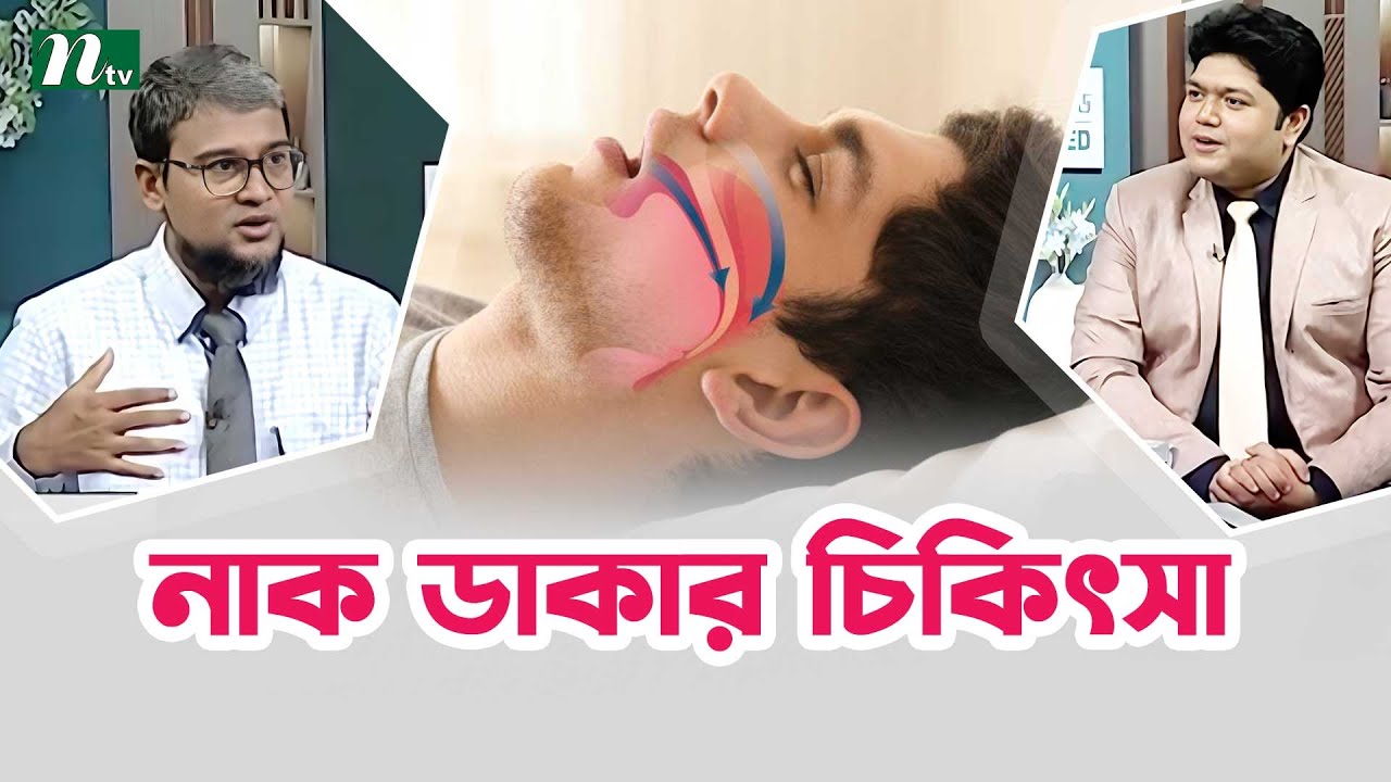 নাক ডাকার আধুনিক চিকিৎসা পদ্ধতি ও ডাক্তারের পরামর্শ । Health Show | স্বাস্থ্য প্রতিদিন |