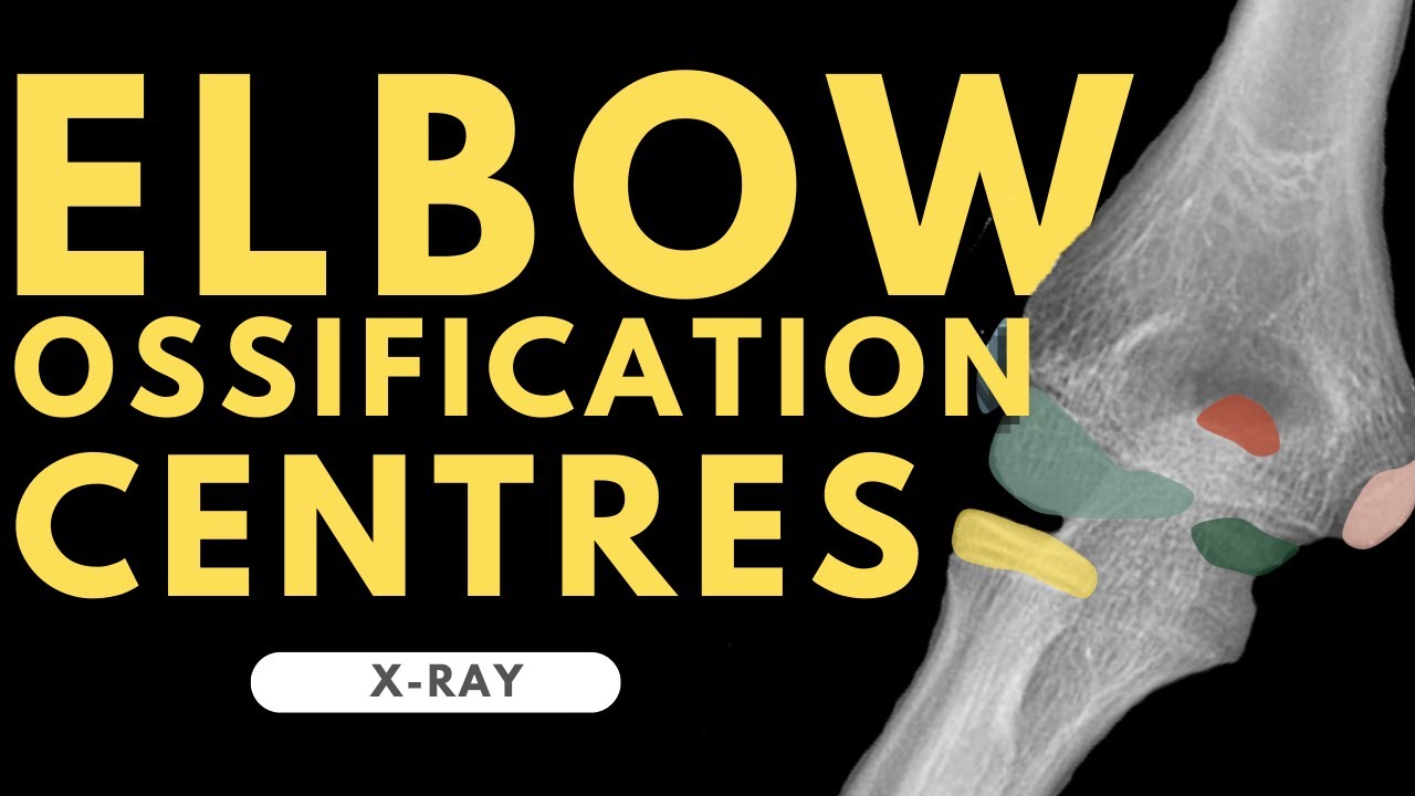 CRITOE - Elbow Ossification Centres | Radiology anatomy part 1 prep | Order of Elbow Ossification