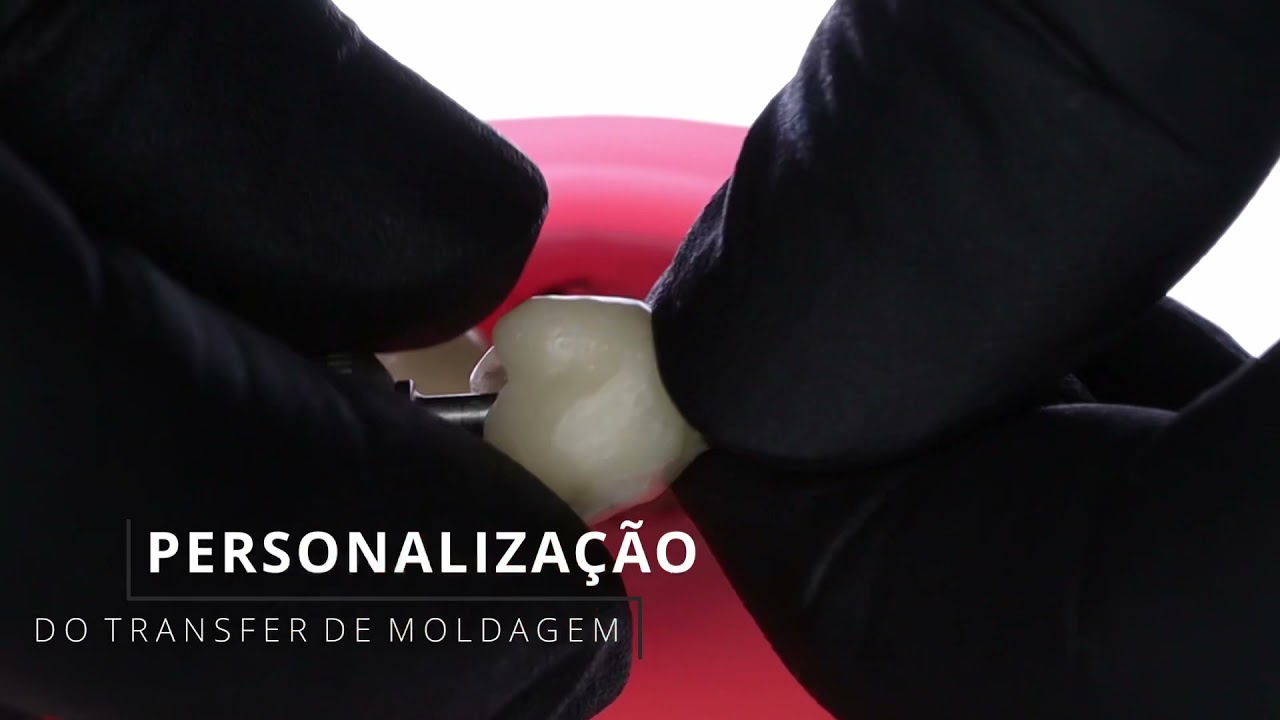 Personalização de transferente de moldagem