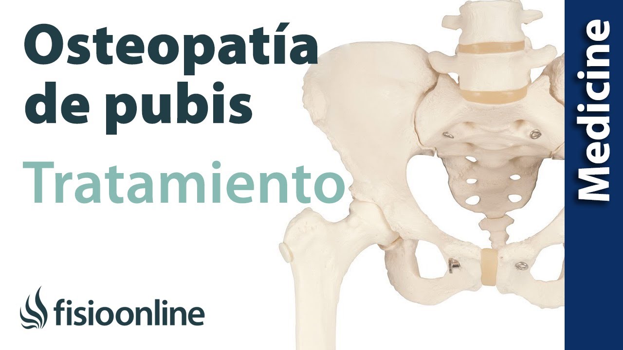 Cómo tratar la Osteopatía de pubis (Quirúrgico y conservador)