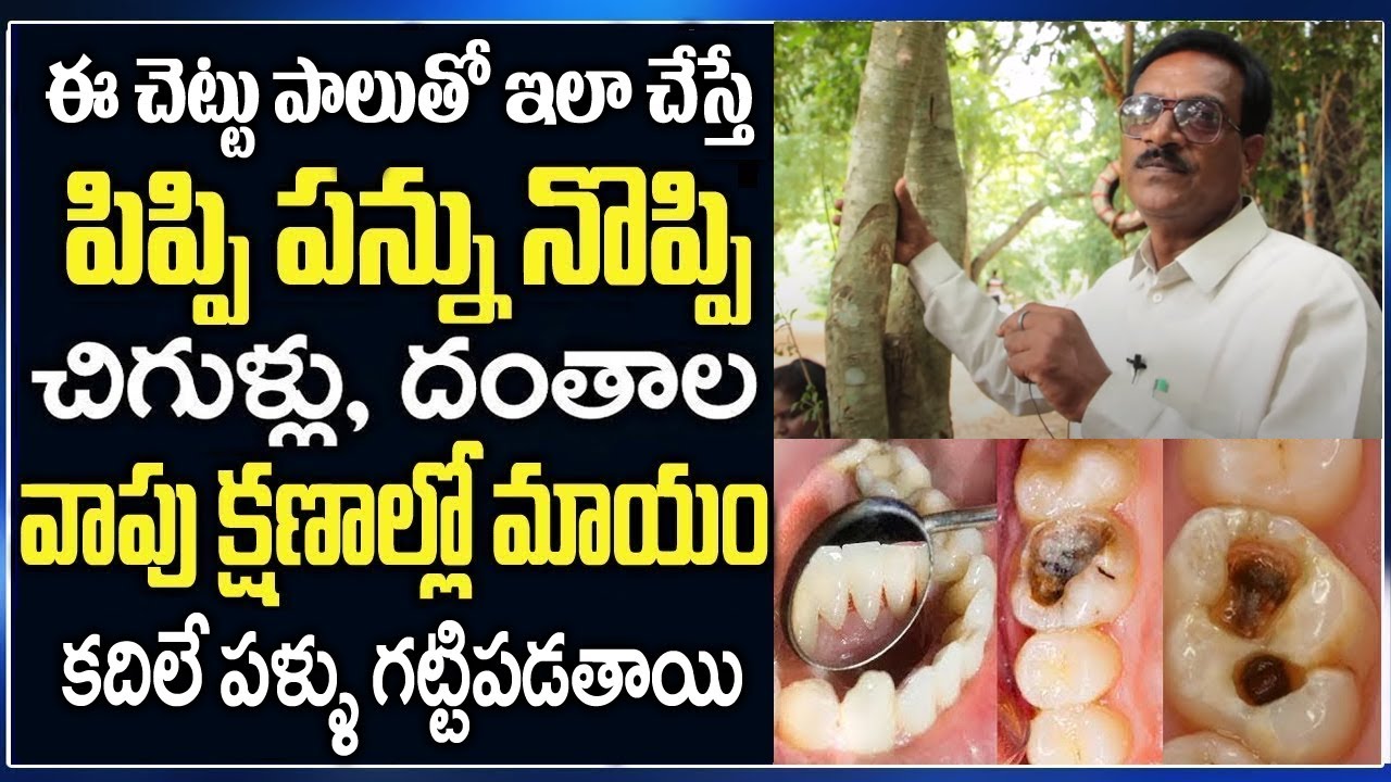 పంటి నొప్పిని తగ్గించే సింపుల్ చిట్కా | Remedies for Toothache | pippi pannu noppiki chitkalu