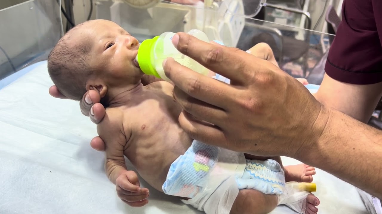 Adorable Twins Baby Feeding Movement | Beautiful Progress in Our NICU