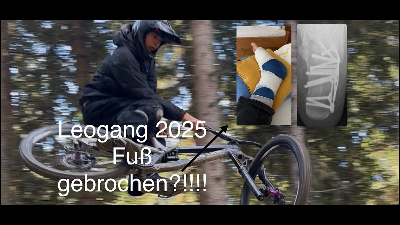 Leogang 2025 endet im Krankenhaus?!!!🙁😍😍😍