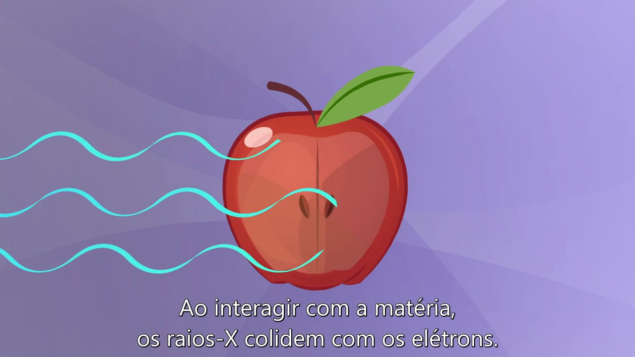 Como funcionam os Raios X