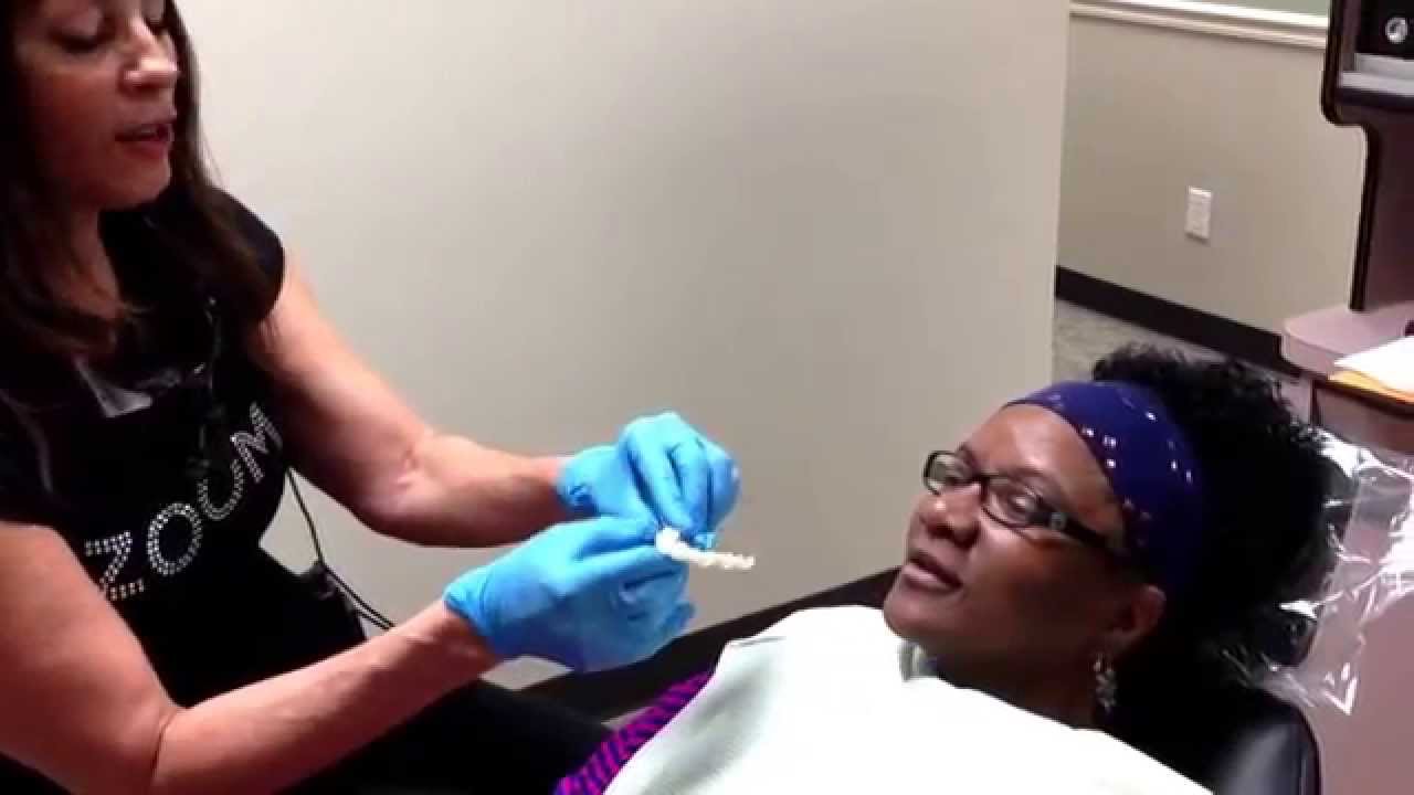 Houston Cosmetic Dentist , The TexasToothLady,..Amazing Dental Makeover With Snap on Smile!!