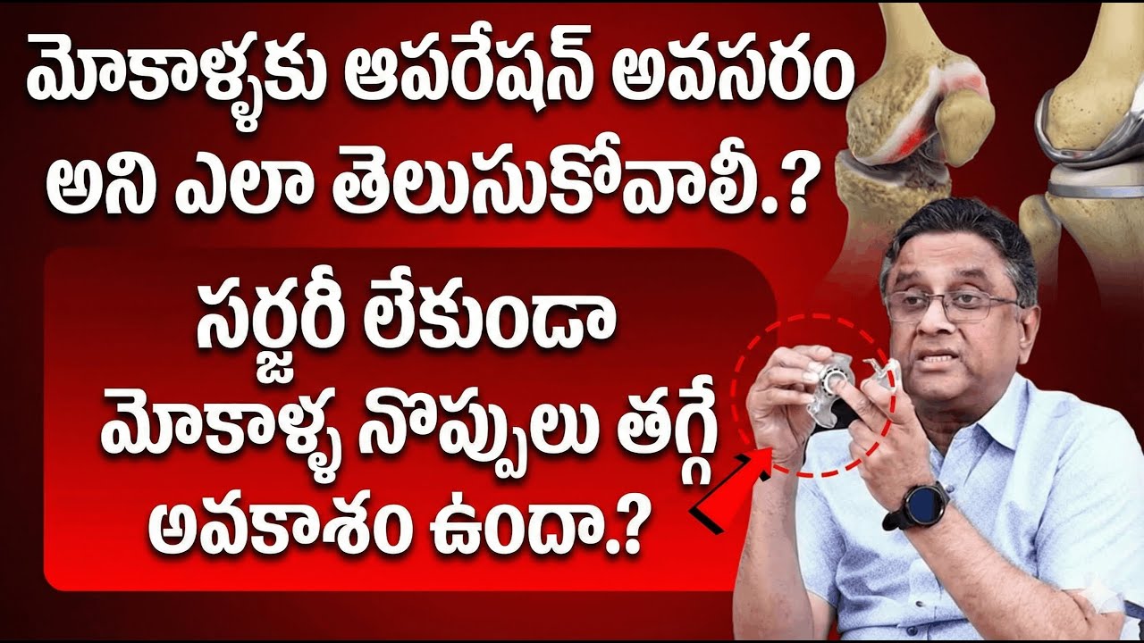 Dr Gurava Reddy Shared Open Fact about Knee Pain Surgery  | Knee Pain Relief | iDream Health Mantra