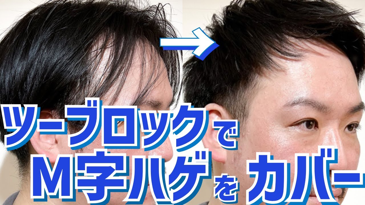 【薄毛】ツーブロックでM字ハゲと前髪の透け感を改善