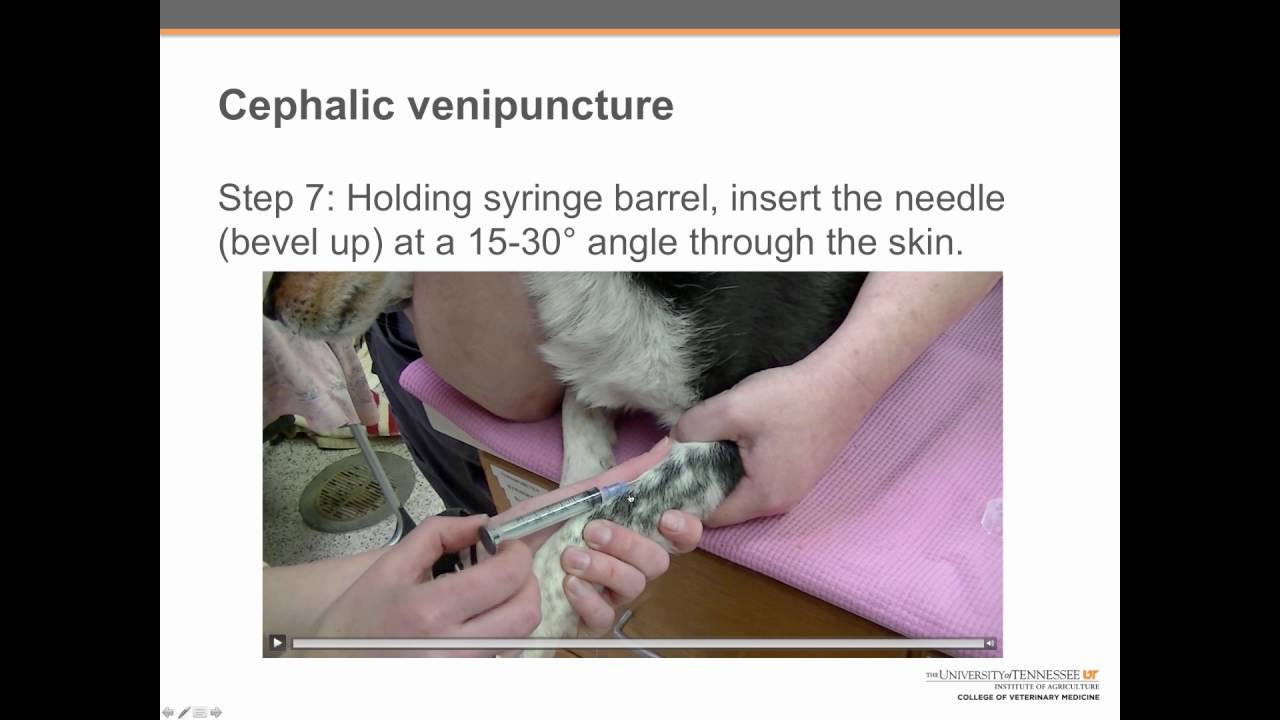 Cephalic venipuncture