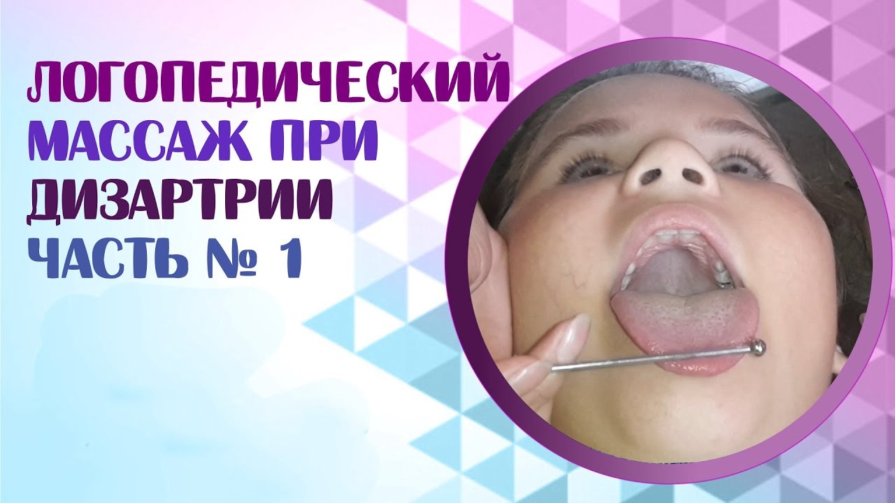 Логопедический массаж при дизартрии.  Постановка звука 