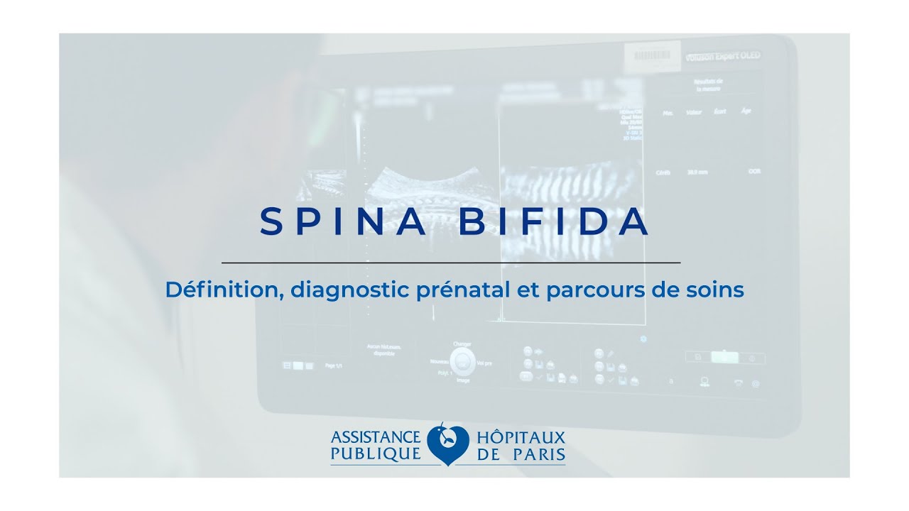 Qu'est-ce que le spina bifida ? Définition, diagnostic prénatal et parcours de soins